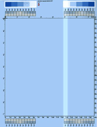 White vertical line(s) or band(s)
